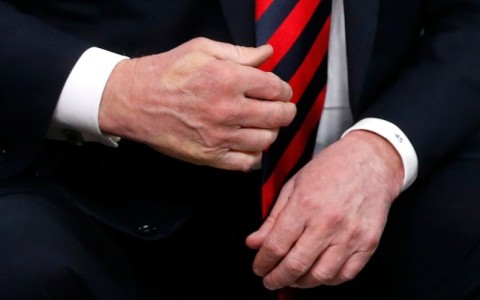 The imprint of French President Emmanuel Macron's thumb can be seen across the back of U.S. President Donald Trump's hand after they shook hands during a bilateral meeting at the G7 Summit in in Charlevoix, Quebec, Canada, June 8, 2018. Photo: REUTERS/Leah Millis