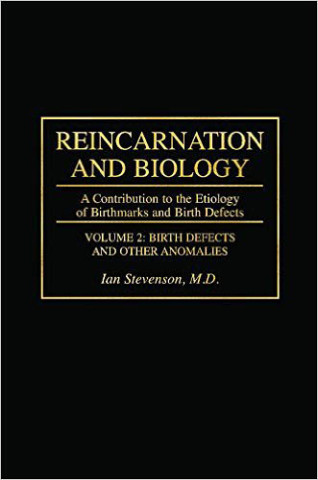 Stevenson-Reincarnation and Biology-A Contribution to the Etiology of Birthmarks and Birth Defects